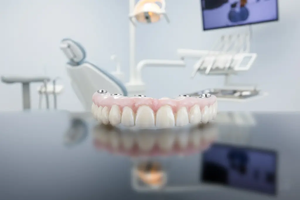 implant-supported dentures